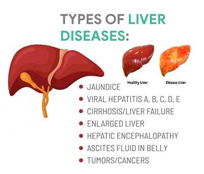 Diseases of Liver